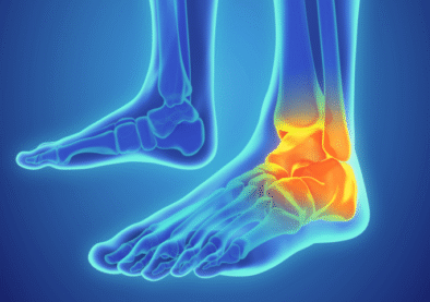 ankle-sprain-768x480 ankle-sprain-768x480